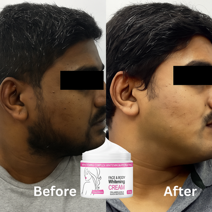 Skin Whitening Cream for Men & Women | Safe for All Skin Types | Instant Glow & Brightening | 50g Pack of 1