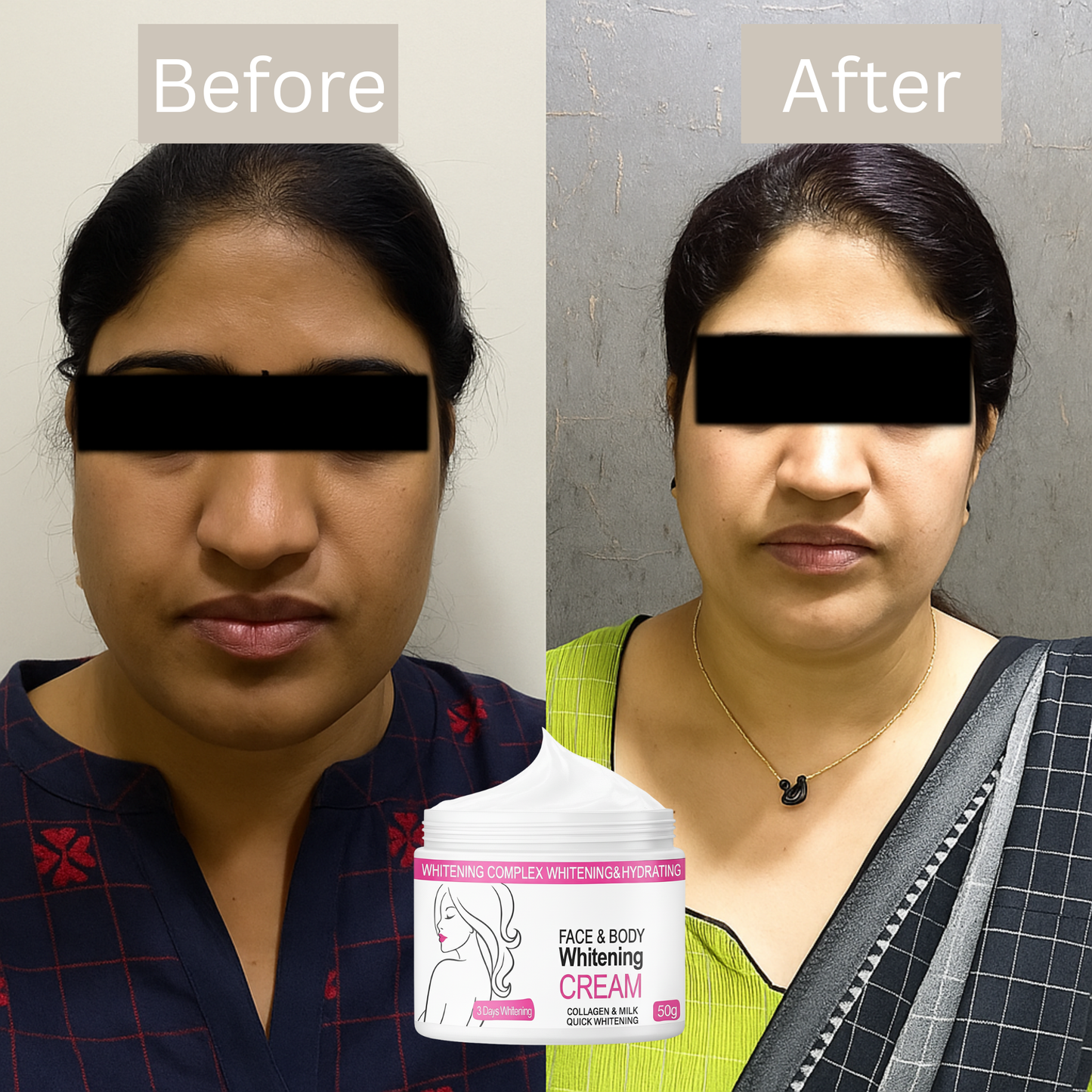 Skin Whitening Cream for Men & Women | Safe for All Skin Types | Instant Glow & Brightening | 50g Pack of 1