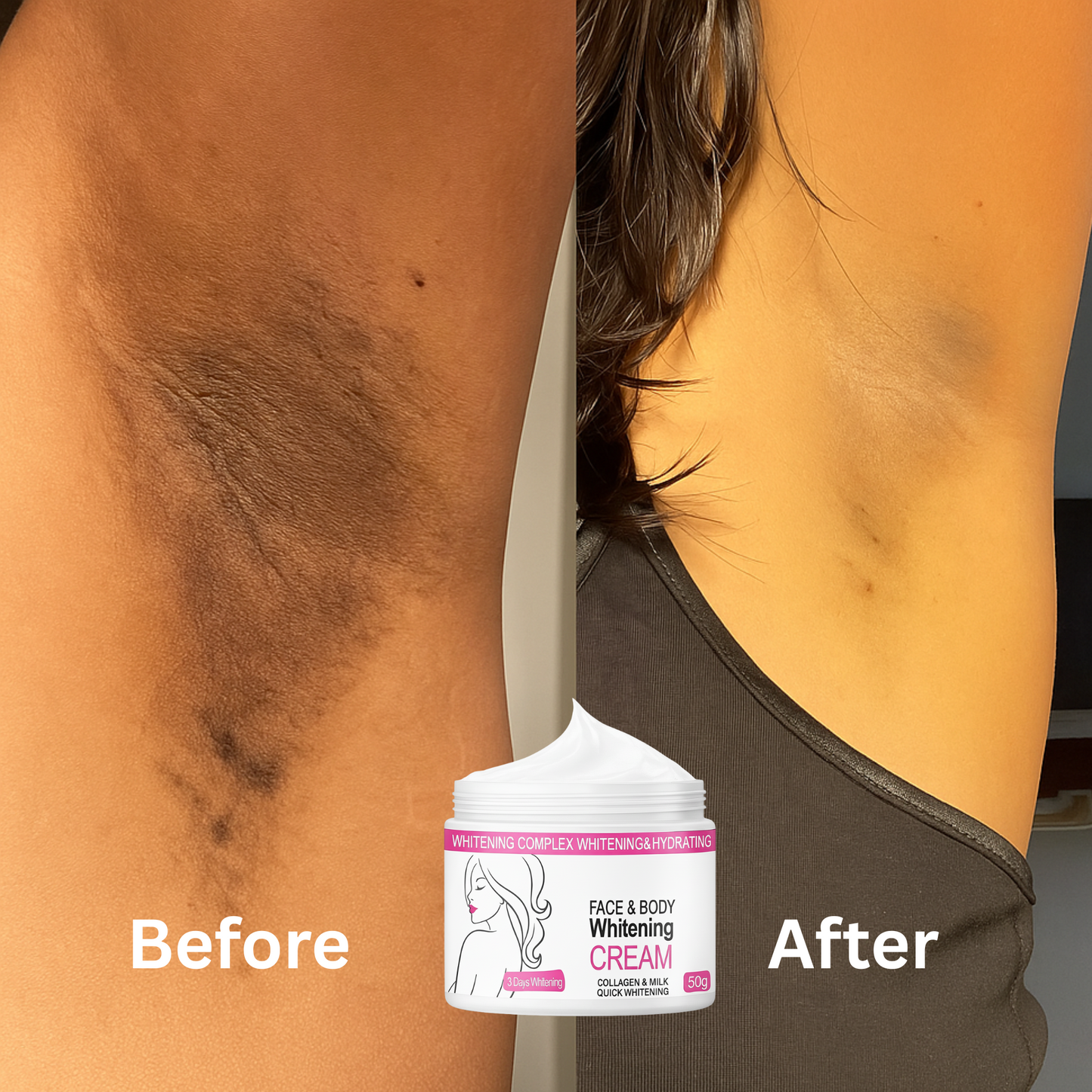 Skin Whitening Cream for Men & Women | Safe for All Skin Types | Instant Glow & Brightening | 50g Pack of 1