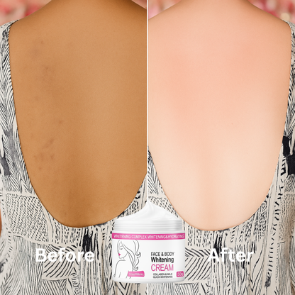 Skin Whitening Cream for Men & Women | Safe for All Skin Types | Instant Glow & Brightening | 50g Pack of 1