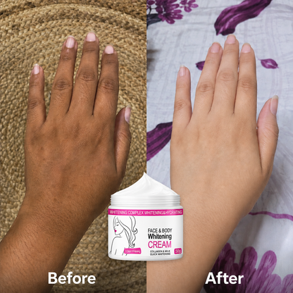 Skin Whitening Cream for Men & Women | Safe for All Skin Types | Instant Glow & Brightening | 50g Pack of 1