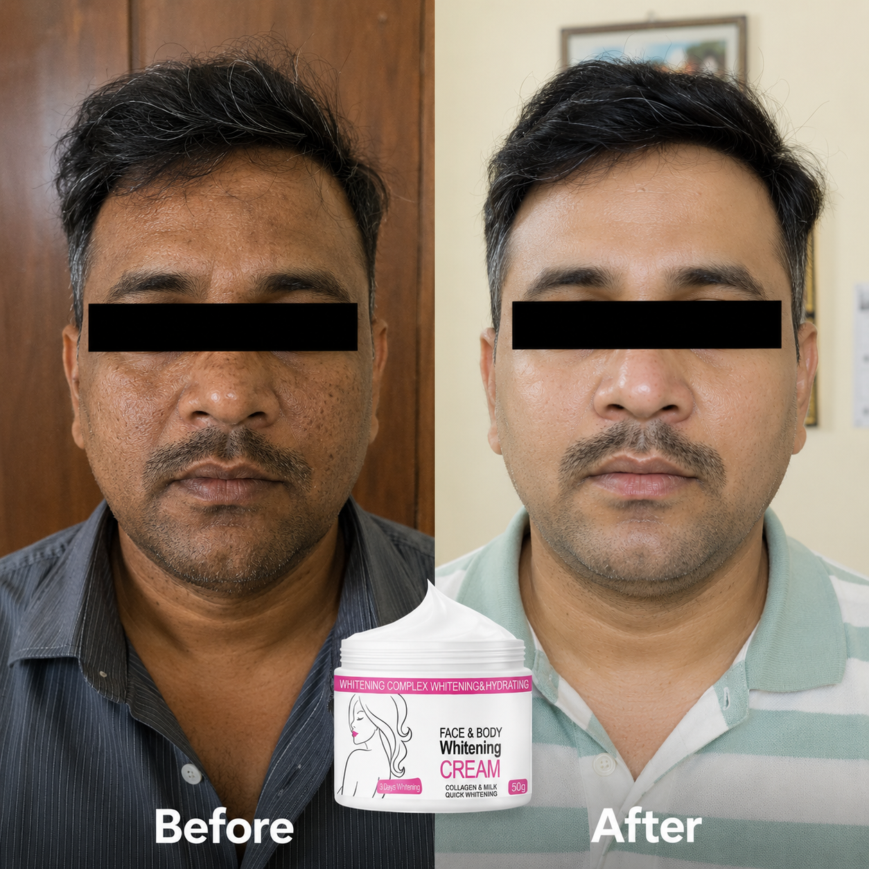 Skin Whitening Cream for Men & Women | Safe for All Skin Types | Instant Glow & Brightening | 50g Pack of 1
