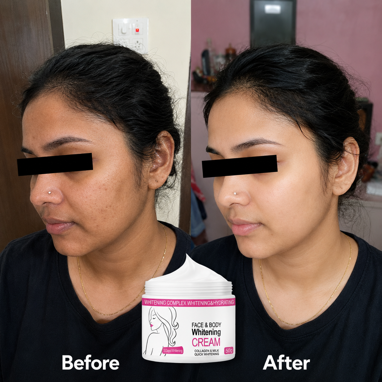 Skin Whitening Cream for Men & Women | Safe for All Skin Types | Instant Glow & Brightening | 50g Pack of 1