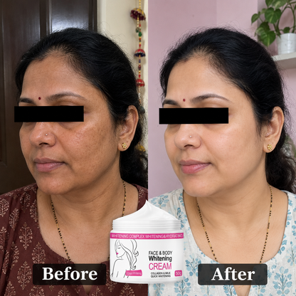 Skin Whitening Cream for Men & Women | Safe for All Skin Types | Instant Glow & Brightening | 50g Pack of 1