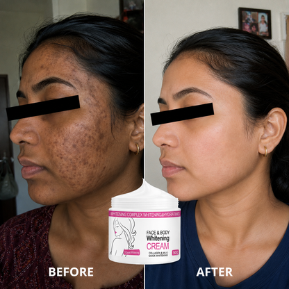 Skin Whitening Cream for Men & Women | Safe for All Skin Types | Instant Glow & Brightening | 50g Pack of 1
