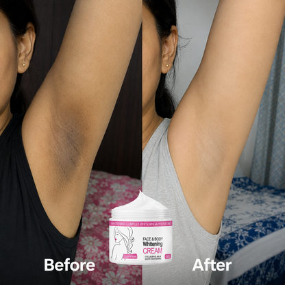 Skin Whitening Cream for Men & Women | Safe for All Skin Types | Instant Glow & Brightening | 50g Pack of 1