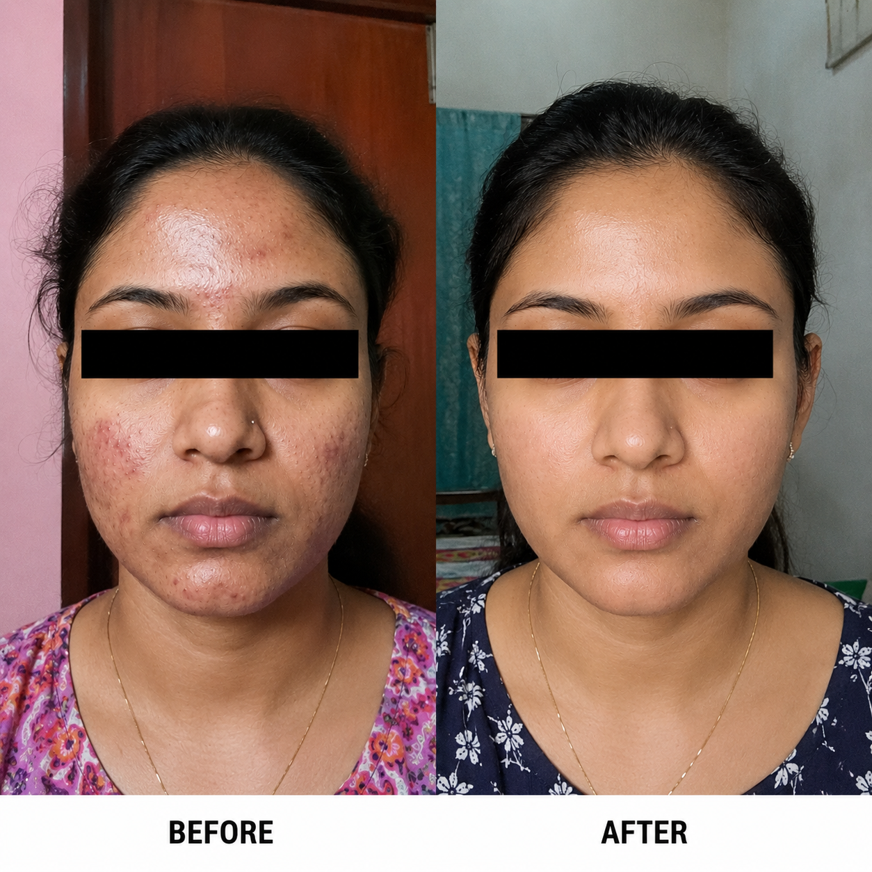 Skin Whitening Cream for Men & Women | Safe for All Skin Types | Instant Glow & Brightening | 50g Pack of 1