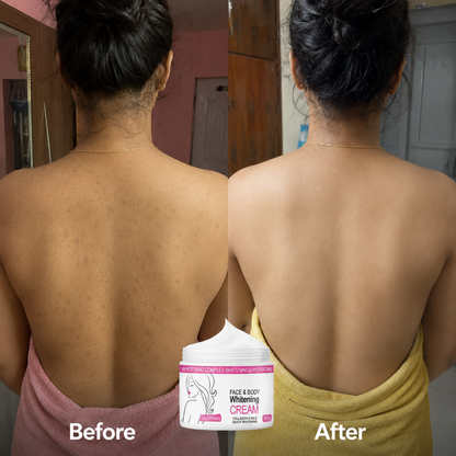Skin Whitening Cream for Men & Women | Safe for All Skin Types | Instant Glow & Brightening | 50g Pack of 1