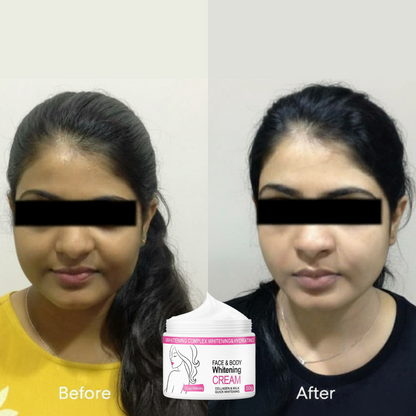 Skin Whitening Cream for Men & Women | Safe for All Skin Types | Instant Glow & Brightening | 50g Pack of 1