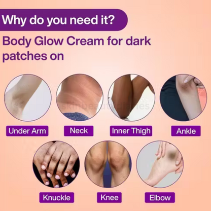 Advanced UnderArm Whitening Cream | (50 g) Pack of 1