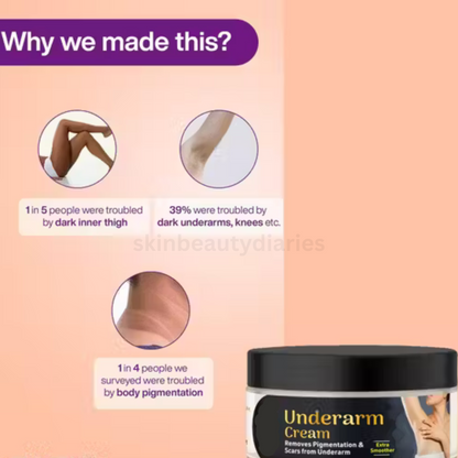 Advanced UnderArm Whitening Cream | (50 g) Pack of 1