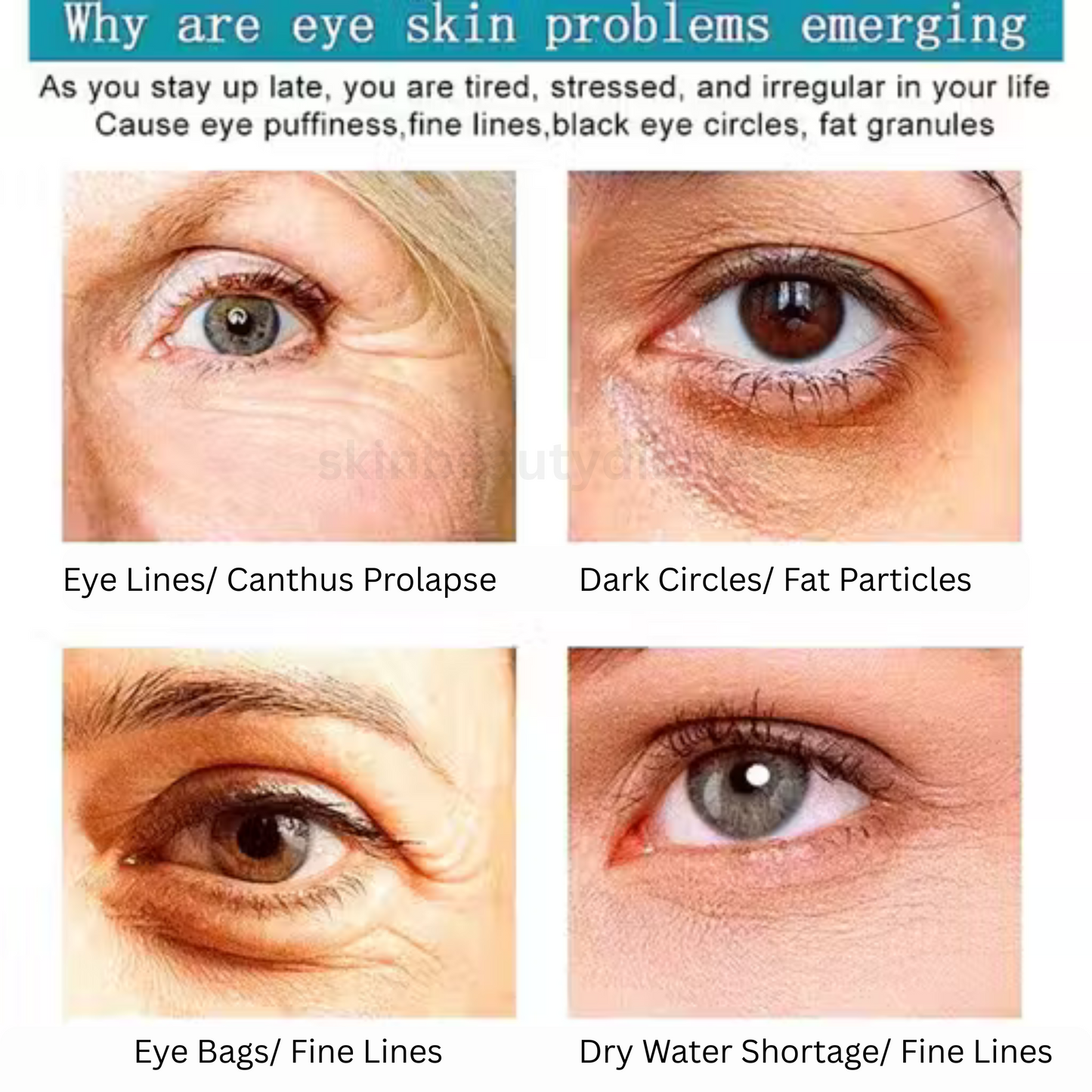 Eye Cream for Dark Circles & Eye Bags – Anti-Wrinkle & Puffiness Remover for Women & Men (50gm, Pack of 1)